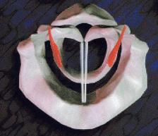 adductedlarynx